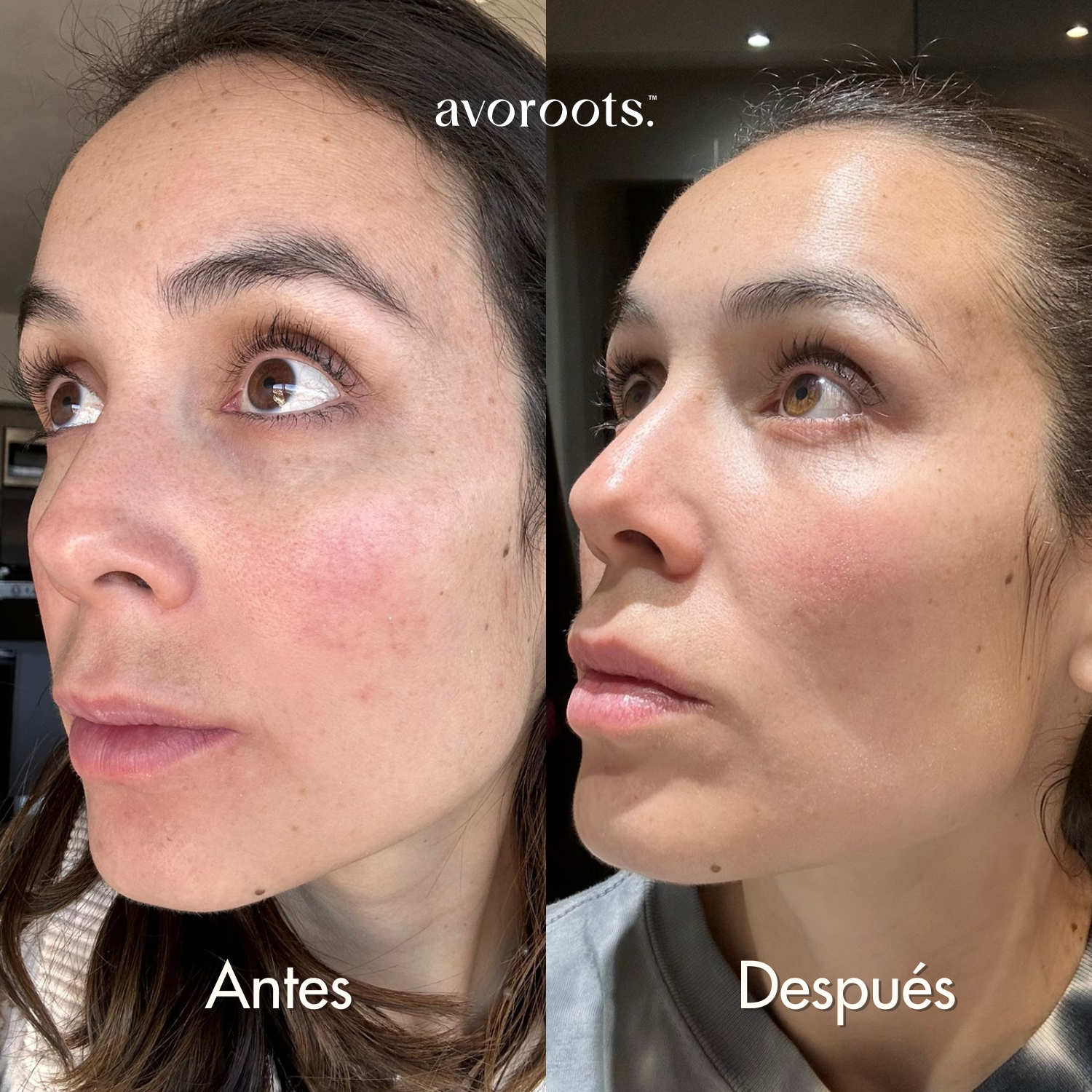 Night Duology 1 &2 : Anti-aging & Anti-spot Cream + Hydrating Serum