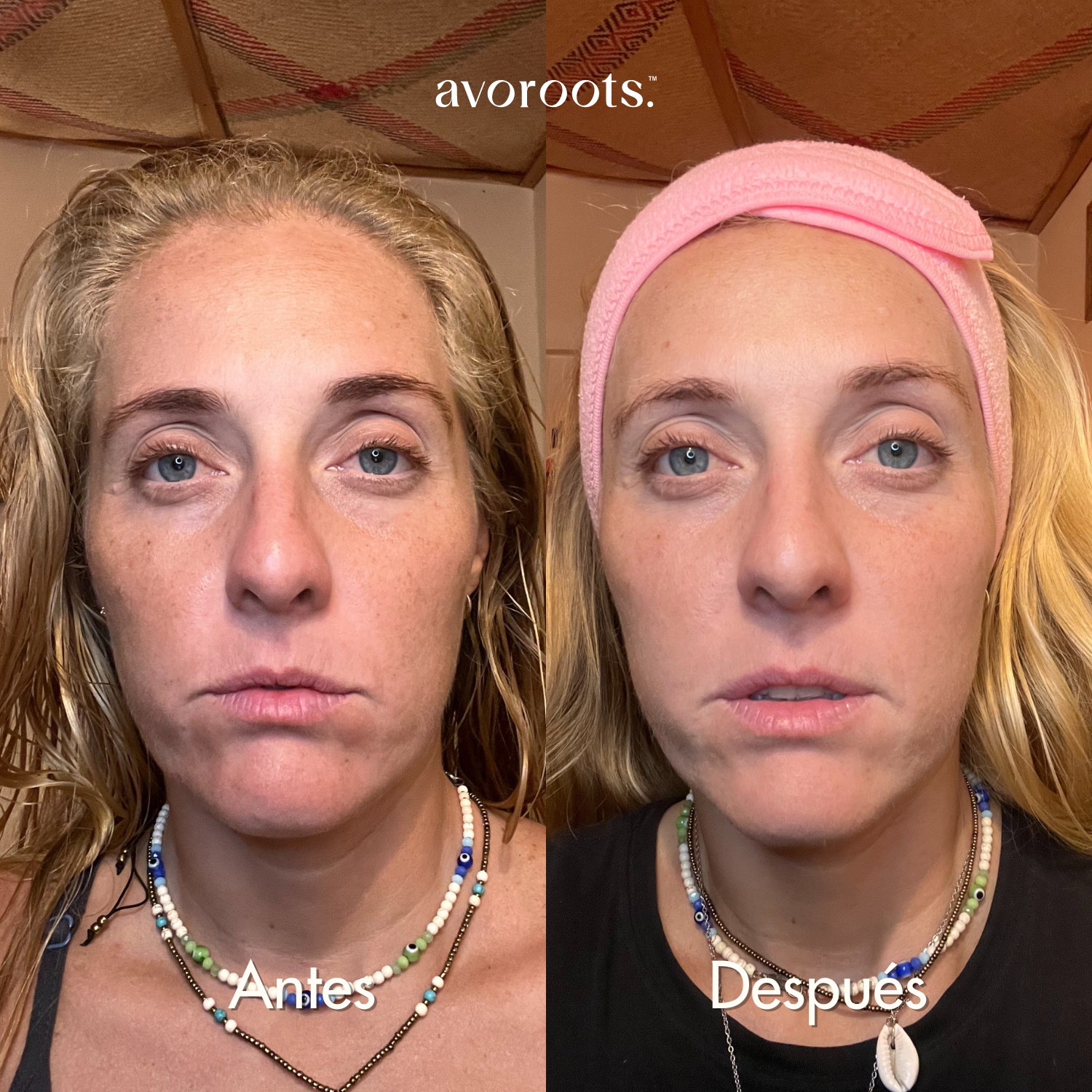 Night Duology 1 &2 : Anti-aging & Anti-spot Cream + Hydrating Serum